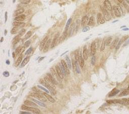 Detection of human CDC6 by immunohistochemistry.