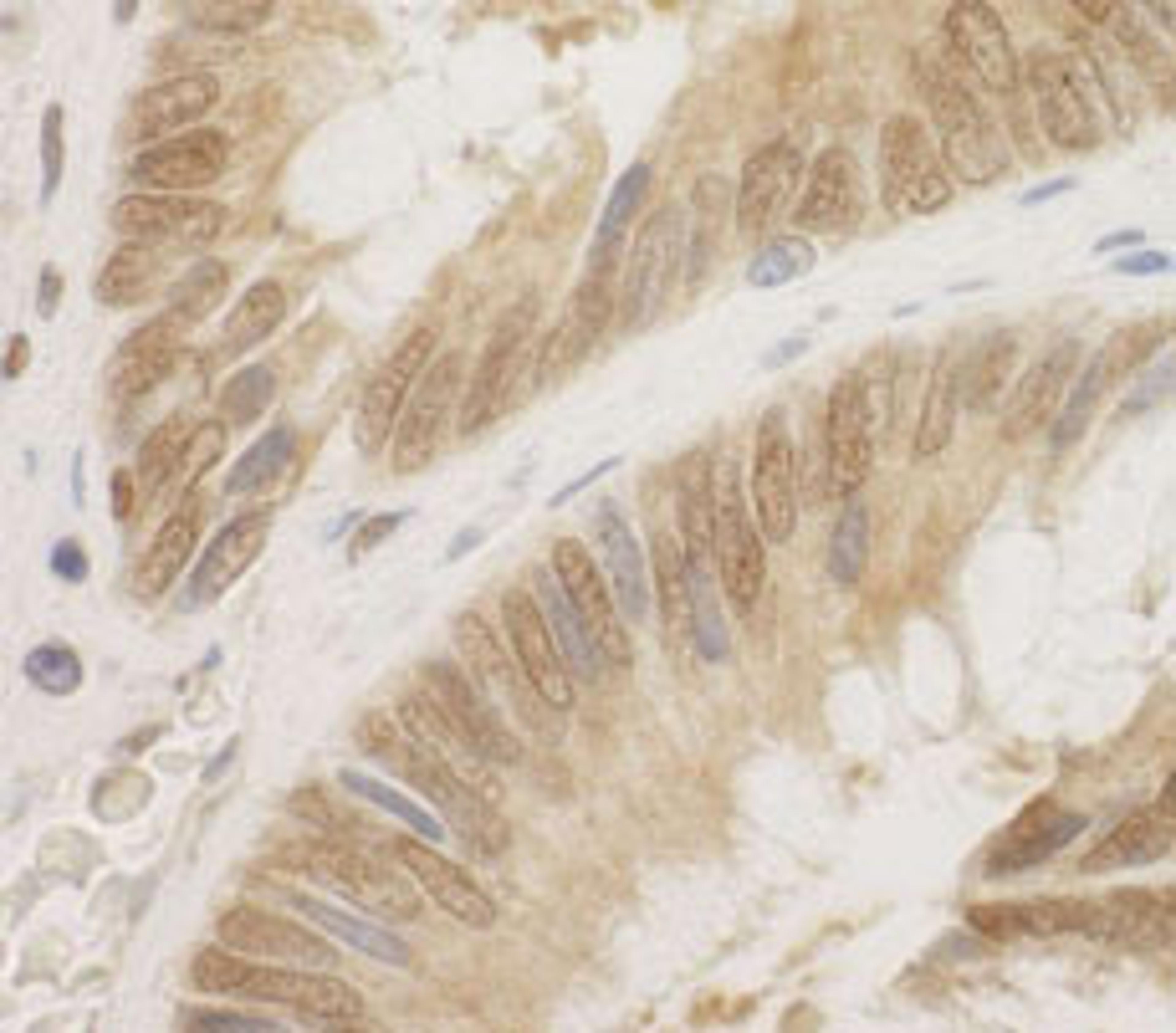 Detection of human CDC6 by immunohistochemistry.