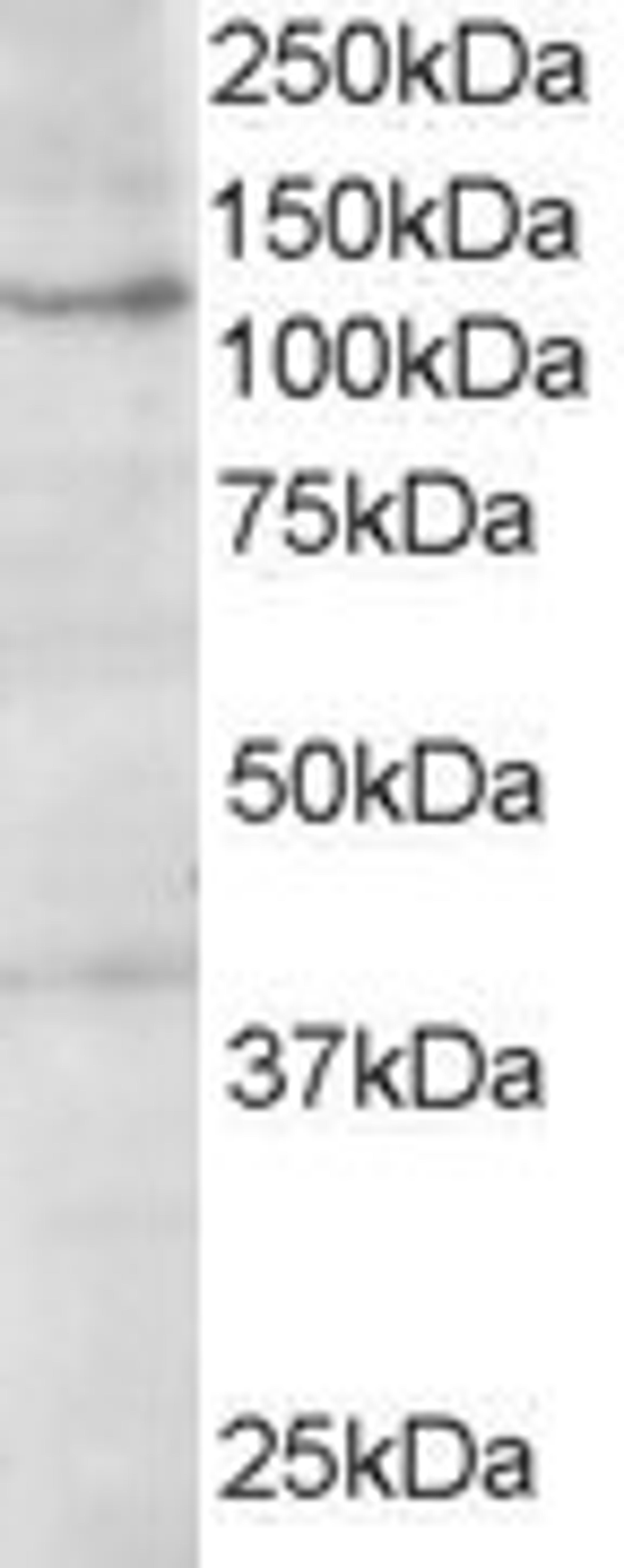 45-744 (1ug/ml) staining of A431 lysate (35ug protein in RIPA buffer). Primary incubation was 1 hour. Detected by chemiluminescence.