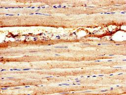 Immunohistochemistry of paraffin-embedded human skeletal muscle tissue using CSB-PA01469A0Rb at dilution of 1:100