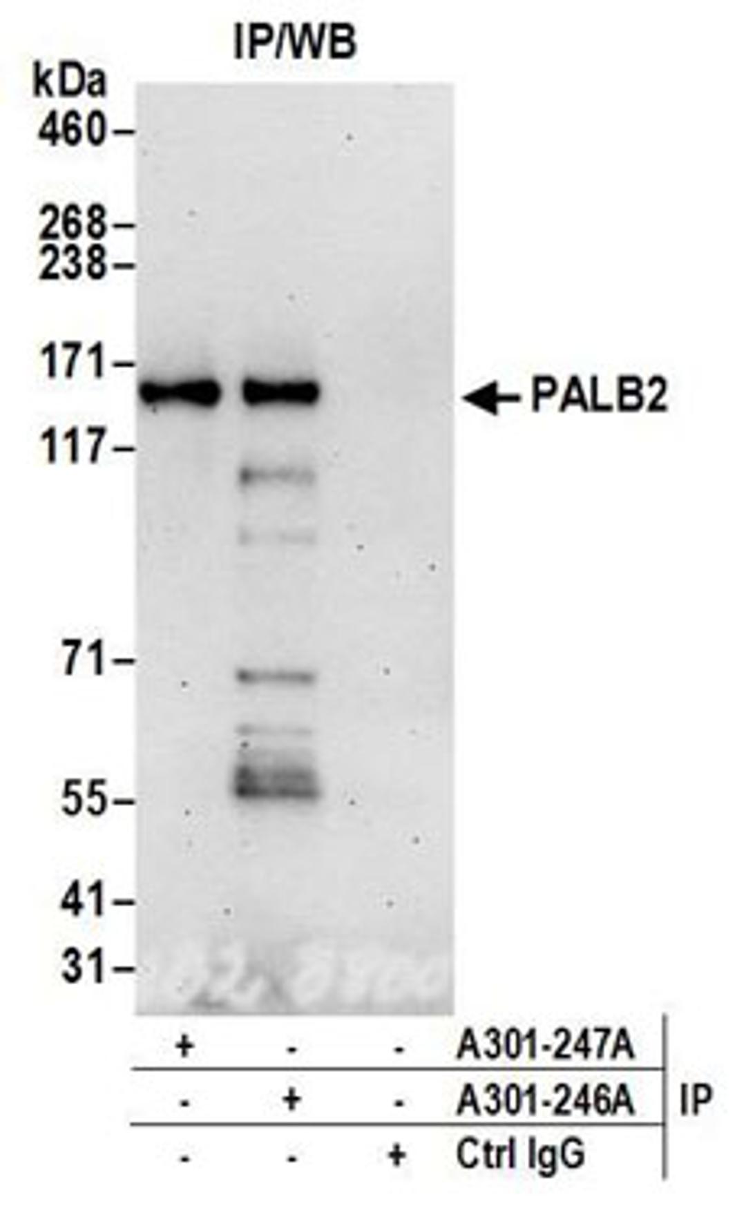 Detection of human PALB2 by western blot of immunoprecipitates.