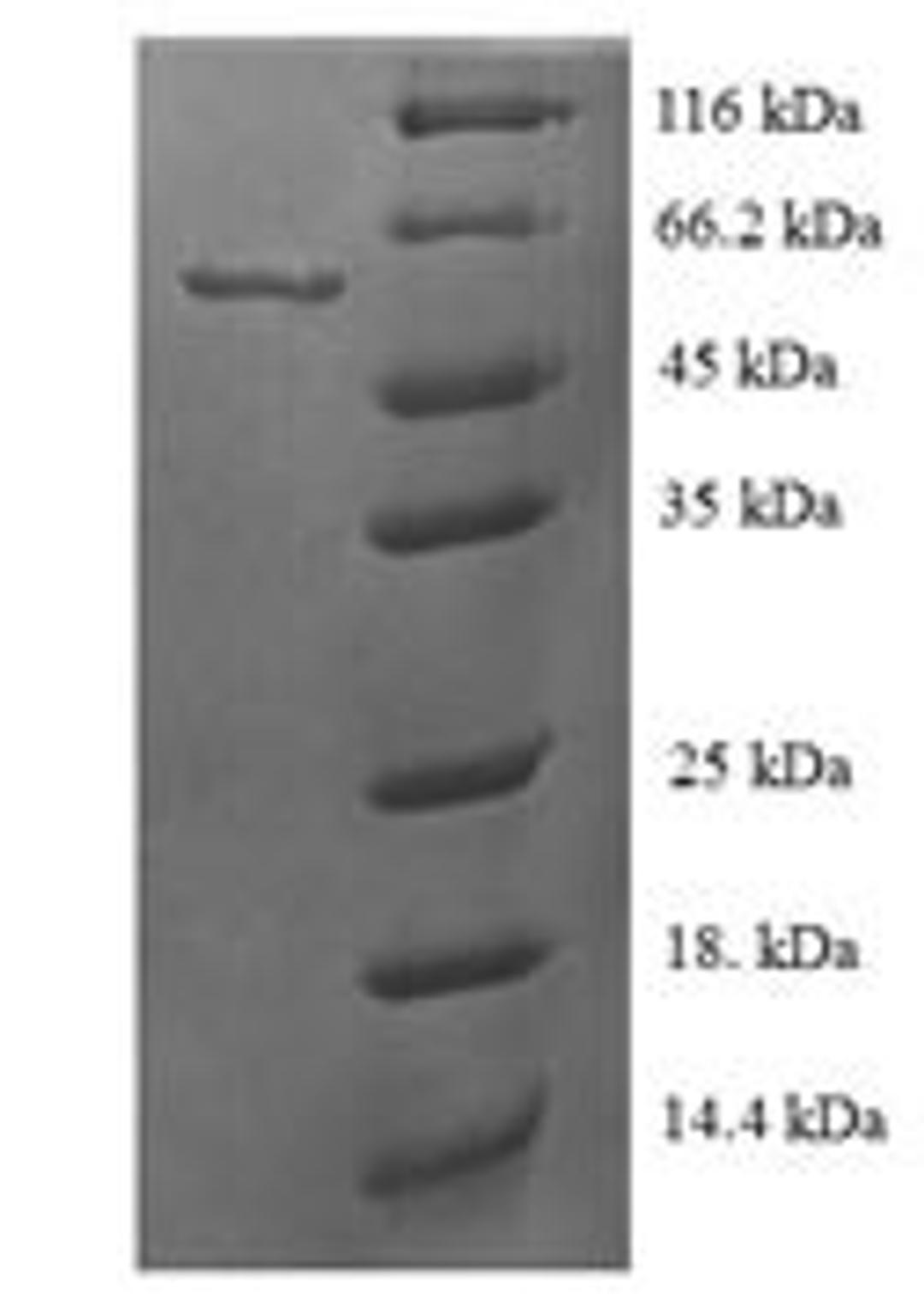 (Tris-Glycine gel) Discontinuous SDS-PAGE (reduced) with 5% enrichment gel and 15% separation gel.