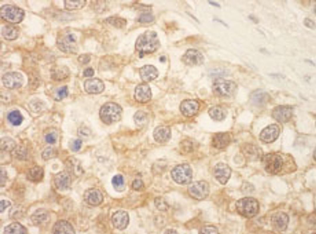 Detection of human SPAK by immunohistochemistry.