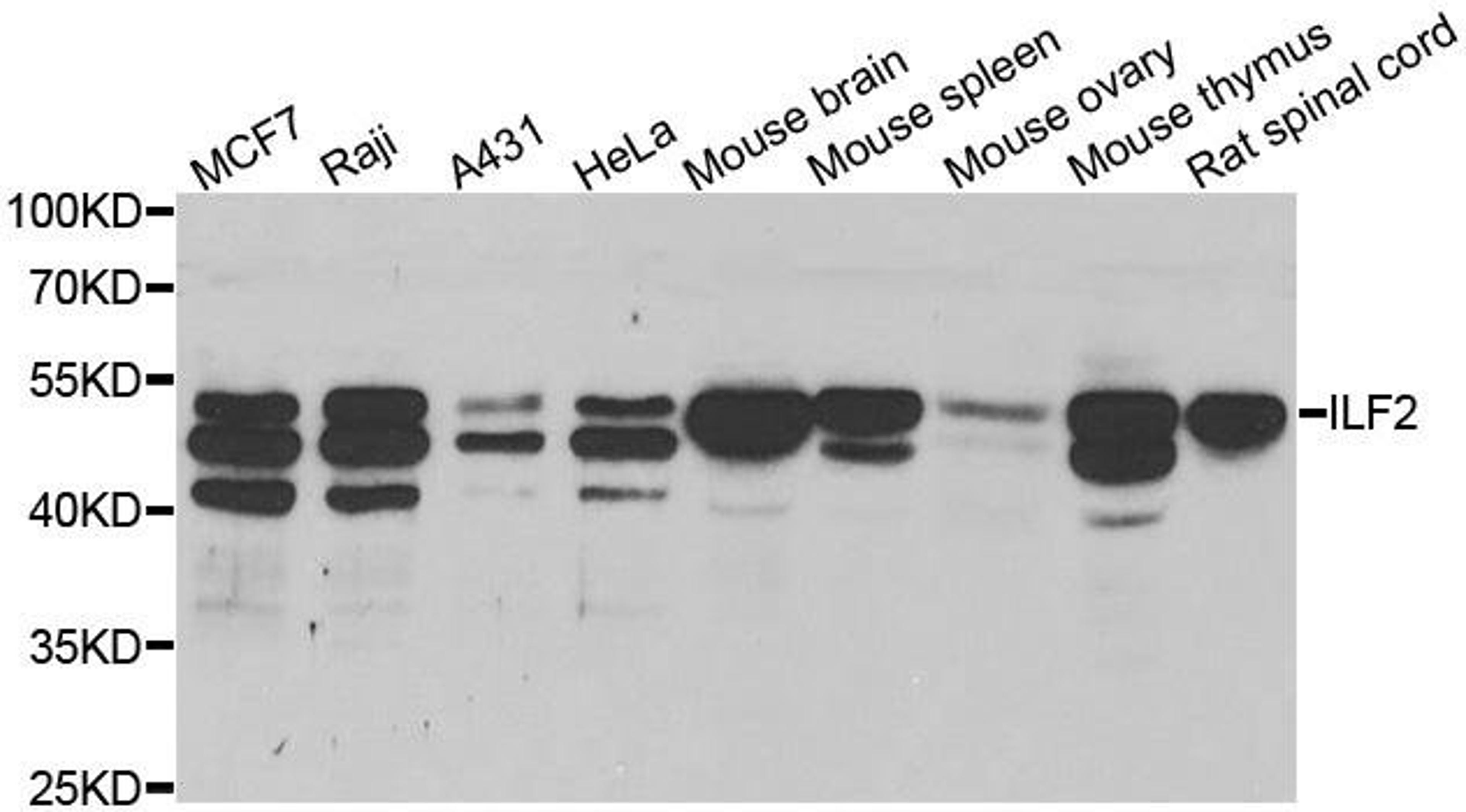 Western blot analysis of extracts of various cell lines using ILF2 antibody