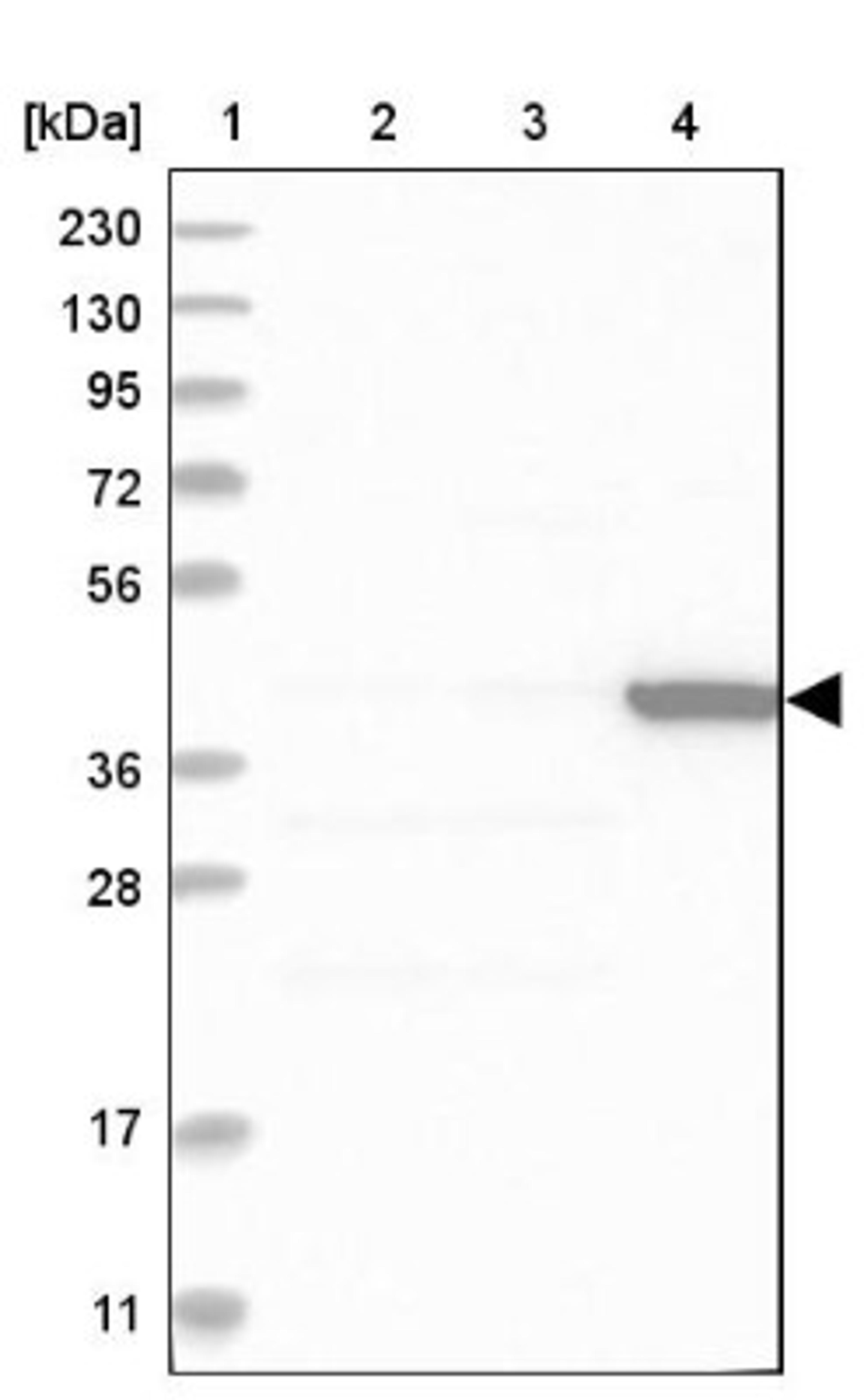 Western Blot: TTYH1 Antibody [NBP1-85992] - Lane 1: Marker [kDa] 230, 130, 95, 72, 56, 36, 28, 17, 11<br/>Lane 2: Human cell line RT-4<br/>Lane 3: Human cell line U-251MG sp<br/>Lane 4: Human plasma (IgG/HSA depleted)