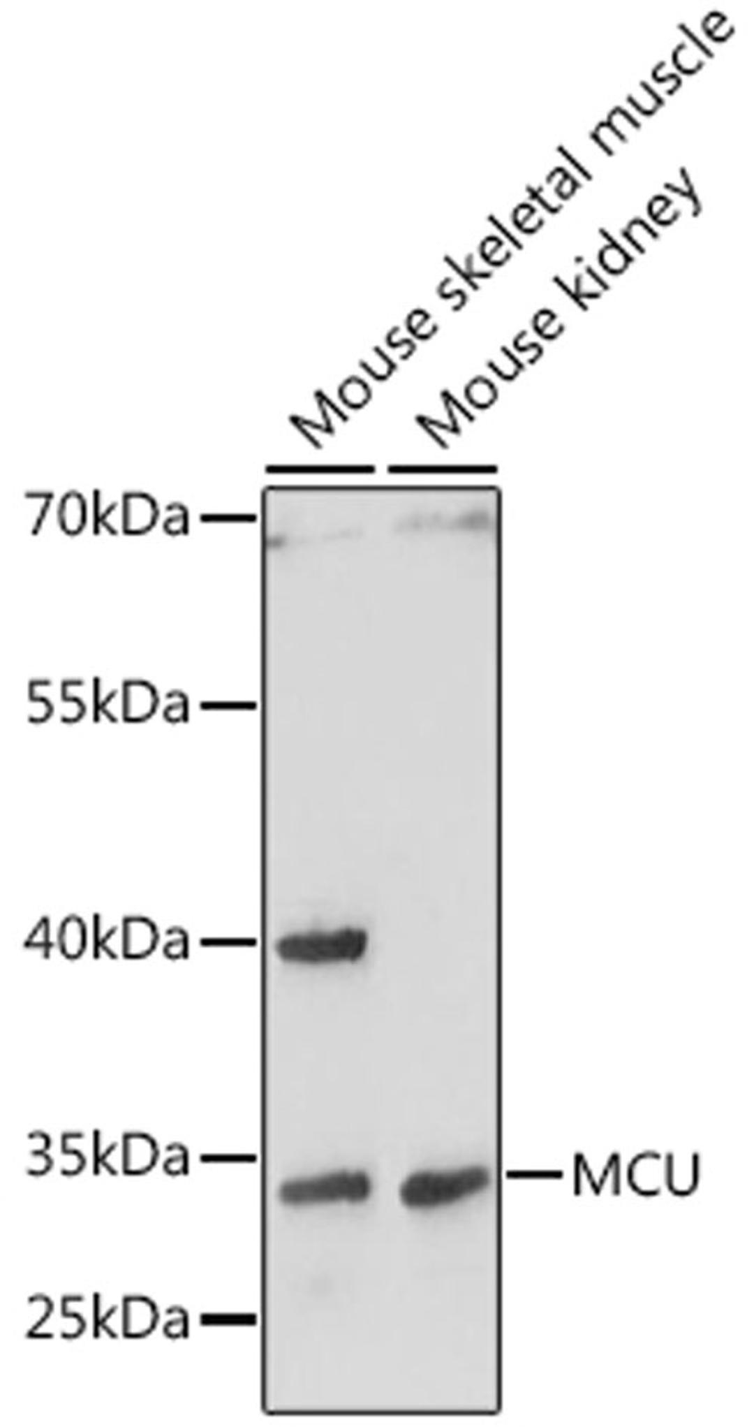 Western blot - MCU antibody (A16281)