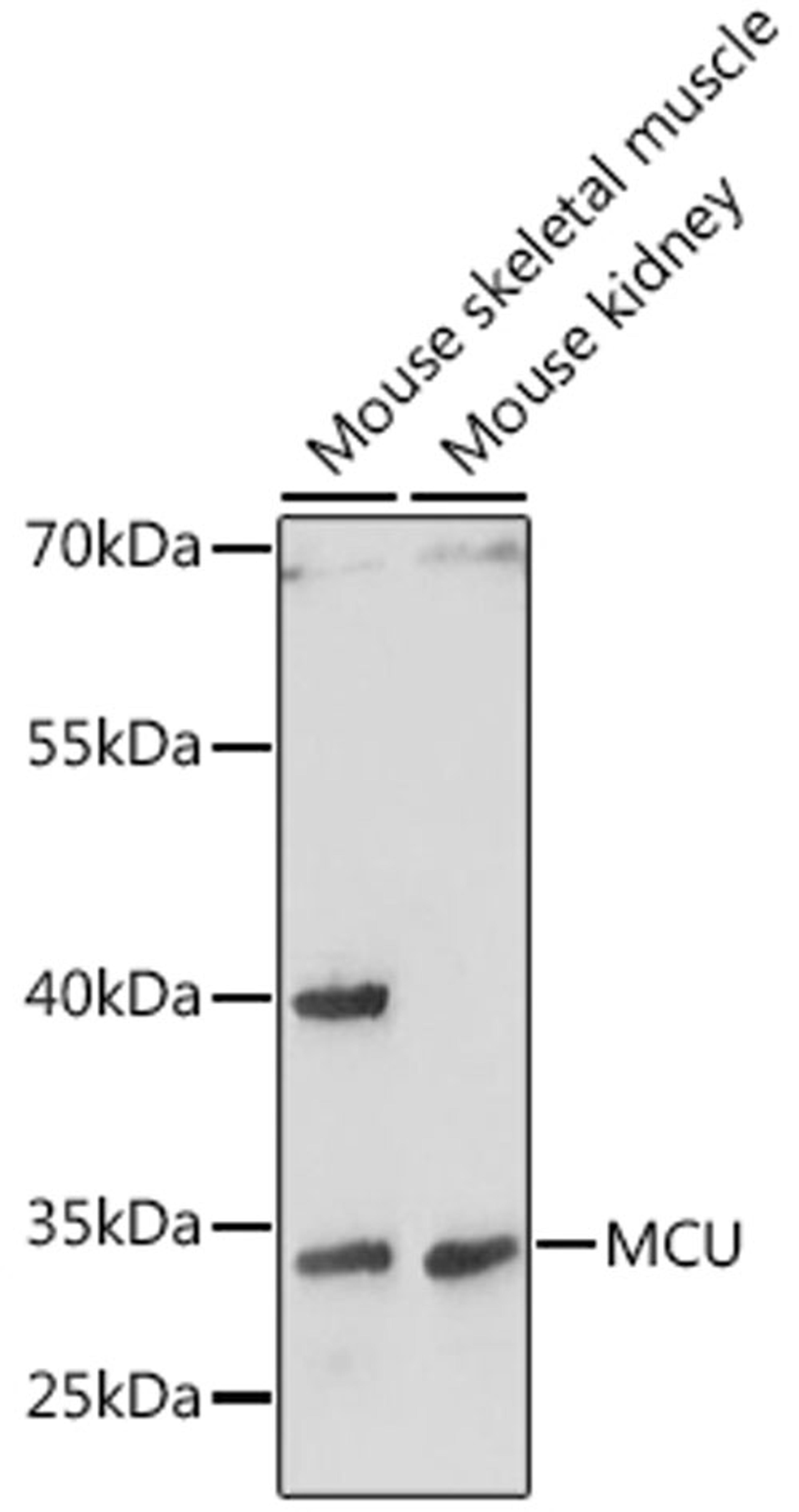 Western blot - MCU antibody (A16281)