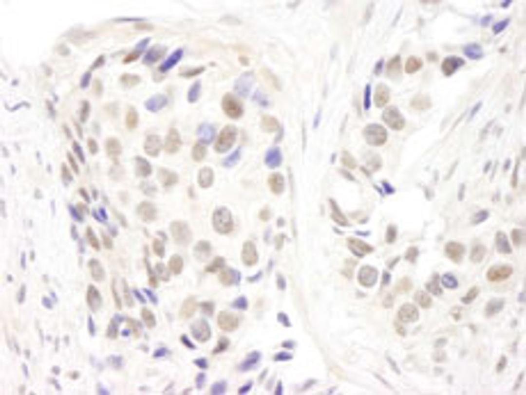 Detection of human p66alpha by immunohistochemistry.