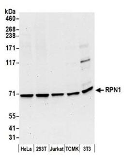 Detection of human and mouse RPN1 by western blot.