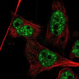 Immunocytochemistry/Immunofluorescence: CT110 Antibody [NBP1-88045] - Staining of human cell line U-251MG shows positivity in nucleus but not nucleoli.