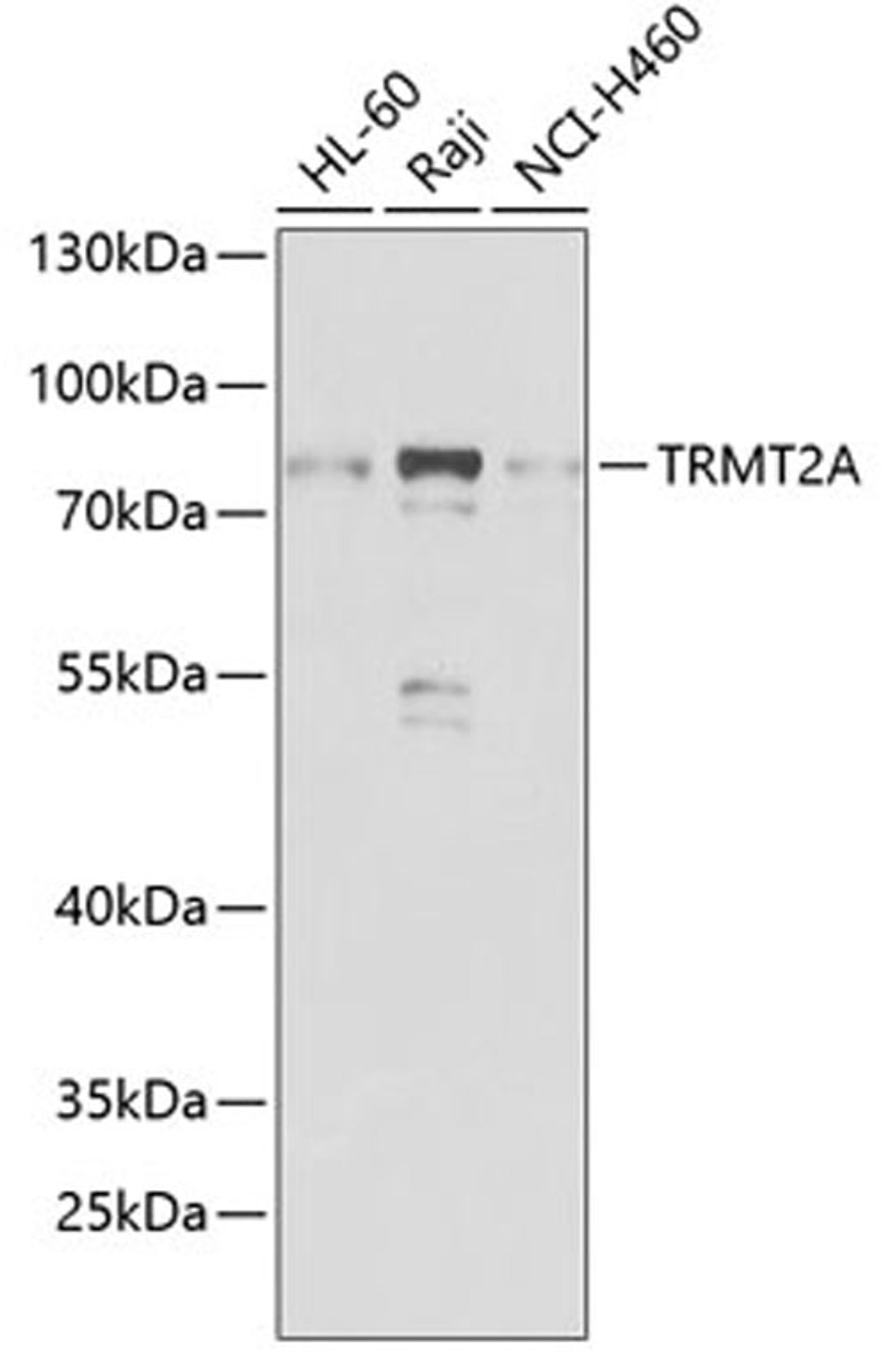 Western blot - TRMT2A antibody (A7095)