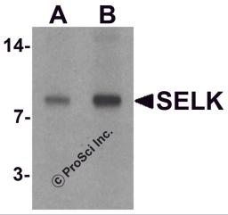 Western blot analysis of SELK in A20 cell lysate with SELK antibody at (A) 1 and (B) 2 &#956;g/mL.