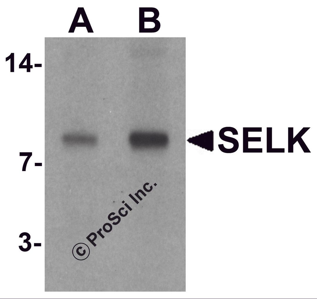 Western blot analysis of SELK in A20 cell lysate with SELK antibody at (A) 1 and (B) 2 μg/mL.