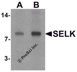 Western blot analysis of SELK in A20 cell lysate with SELK antibody at (A) 1 and (B) 2 μg/mL.
