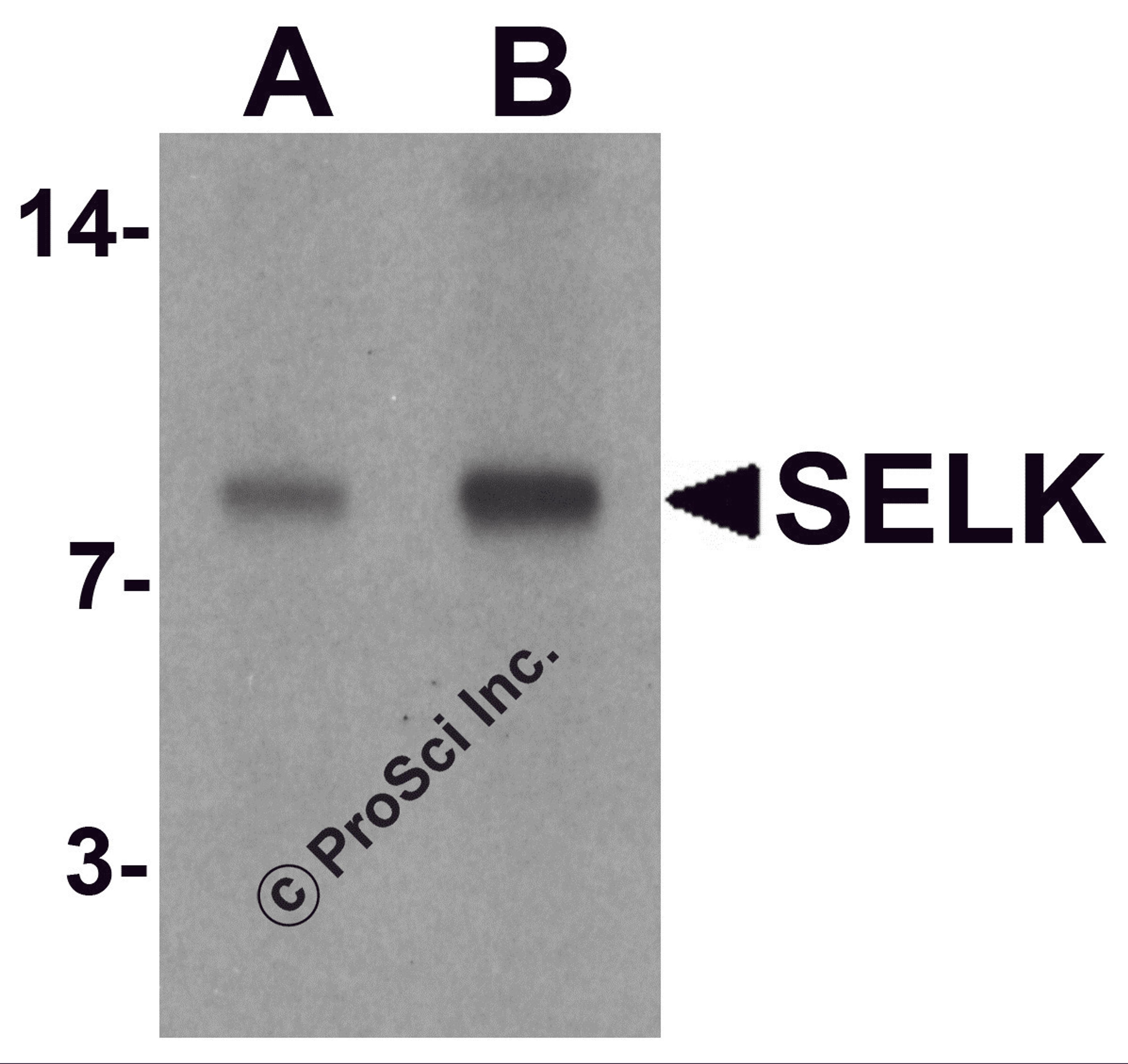 Western blot analysis of SELK in A20 cell lysate with SELK antibody at (A) 1 and (B) 2 μg/mL.