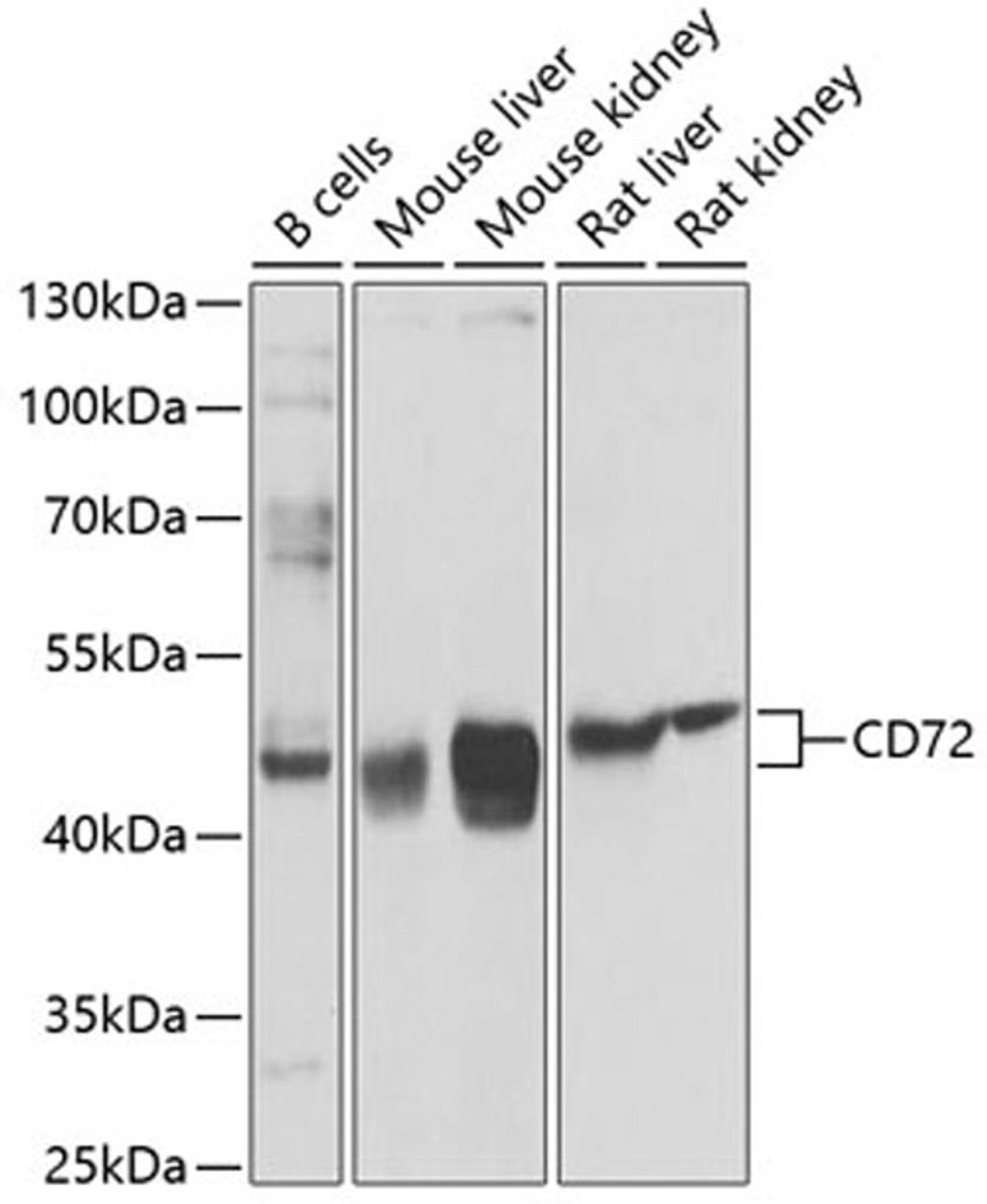 Western blot - CD72 antibody (A9930)