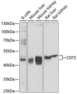 Western blot - CD72 antibody (A9930)