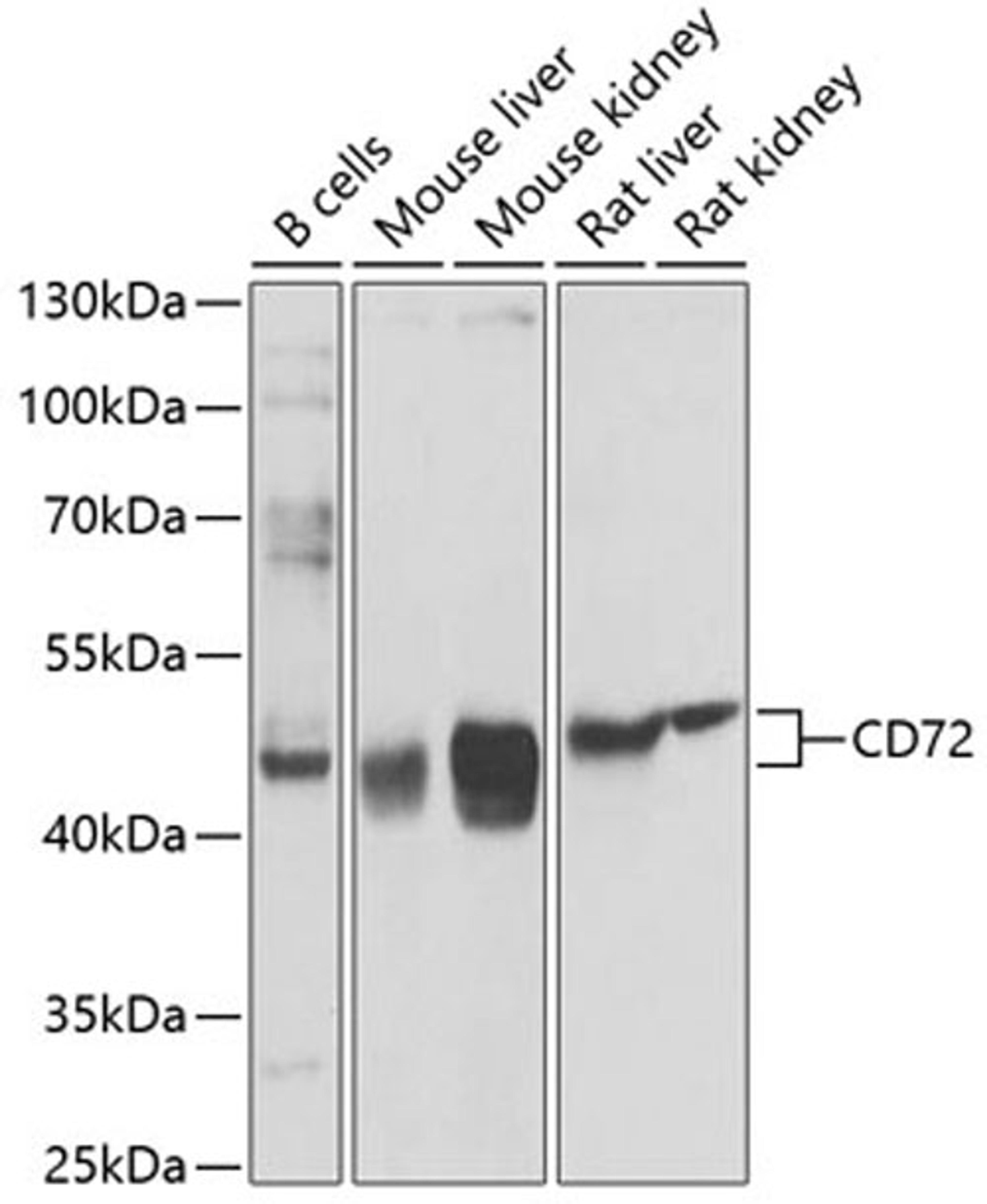 Western blot - CD72 antibody (A9930)