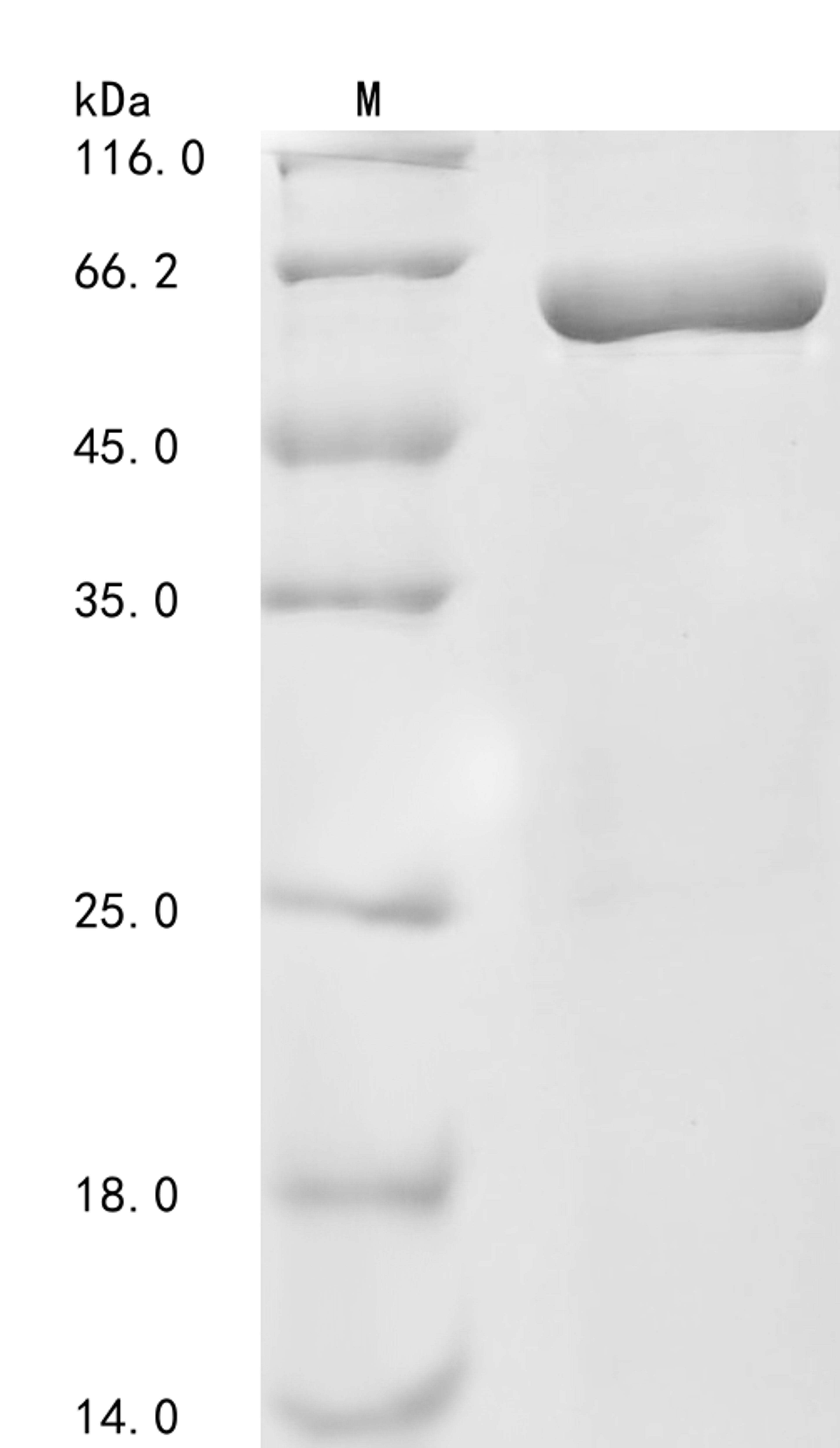 (Tris-Glycine gel) Discontinuous SDS-PAGE (reduced) with 5% enrichment gel and 15% separation gel.