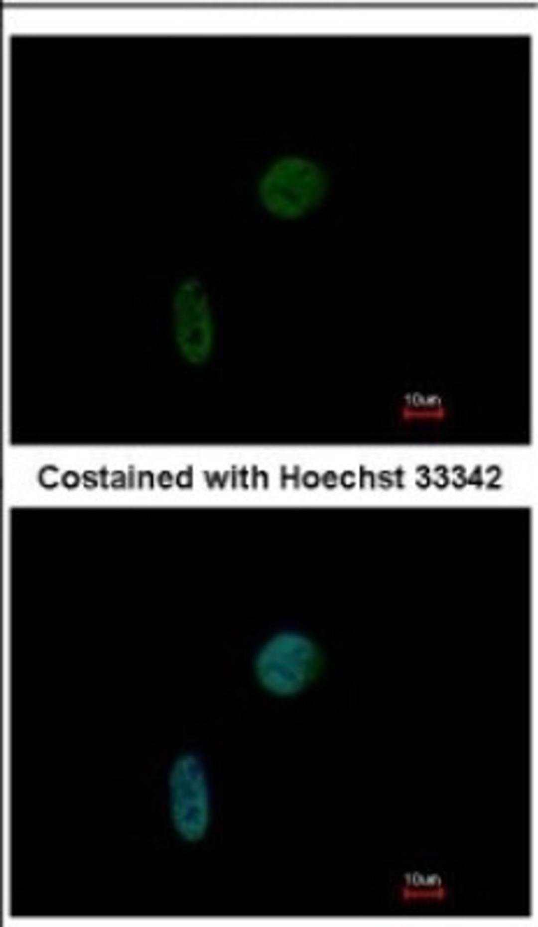 Immunocytochemistry/Immunofluorescence: CIZ1 Antibody [NBP2-15906] - Immunofluorescence analysis of paraformaldehyde-fixed HeLa, using antibody at 1:200 dilution.