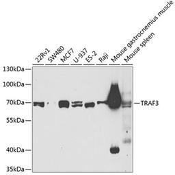 Western blot - TRAF3 antibody (A3094)