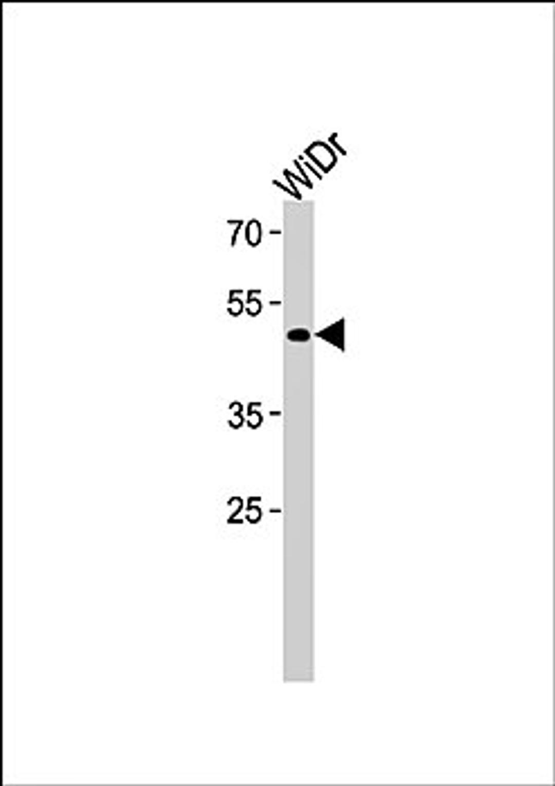 Western blot analysis of WiDr cell line lysates (35ug/lane) using TFDP3 (N-term) antibody