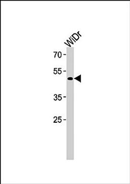 Western blot analysis of WiDr cell line lysates (35ug/lane) using TFDP3 (N-term) antibody