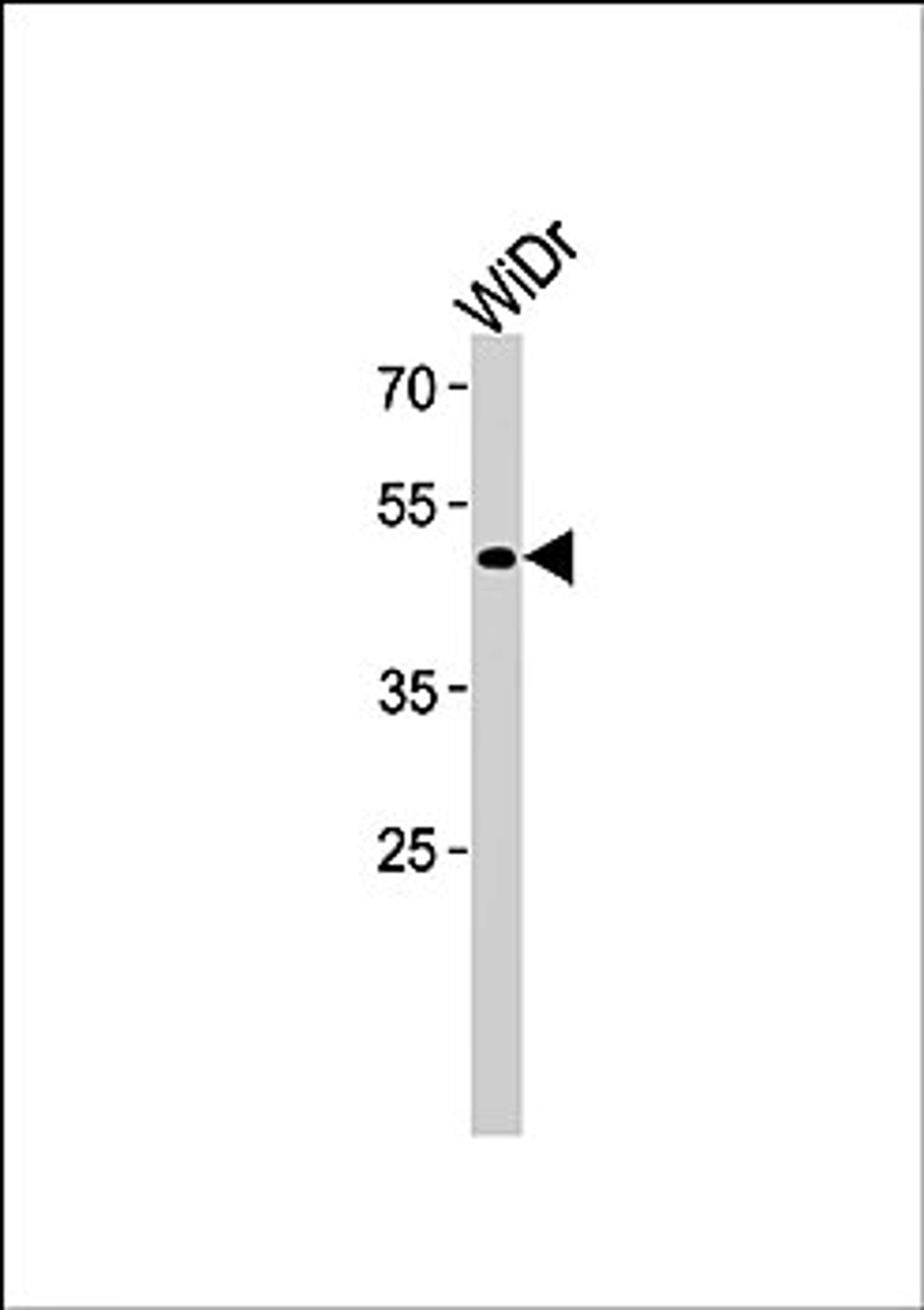 Western blot analysis of WiDr cell line lysates (35ug/lane) using TFDP3 (N-term) antibody