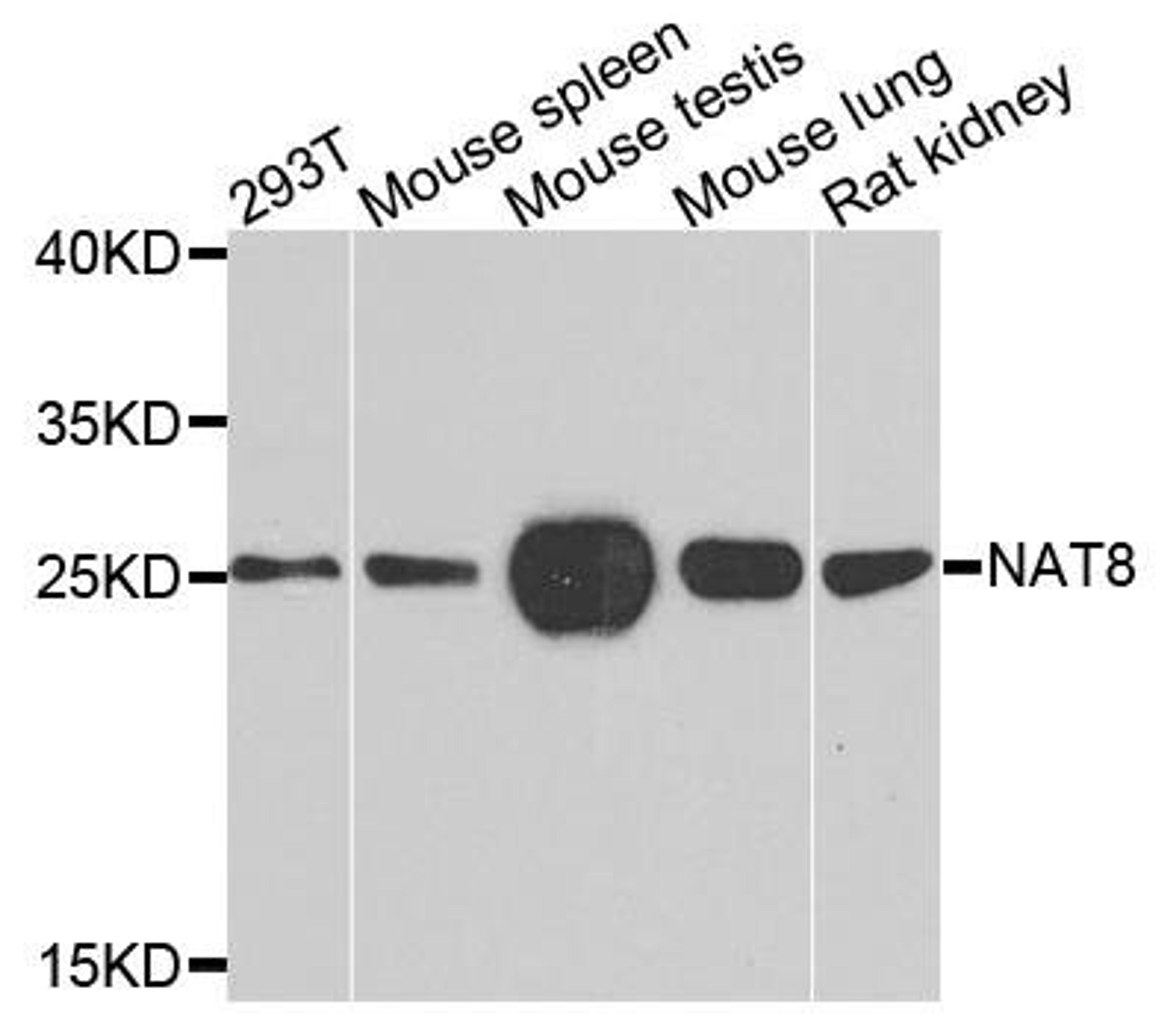 Western blot analysis of extracts of various cells using NAT8 antibody