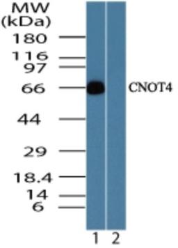 Western Blot: CNOT4 Antibody [NBP2-24527] - analysis of CNOT4 in human skeletal muscle lysate in the 1) absence and 2) presence of immunizing peptide using CNOT4 antibody at 0.05 ug/ml.