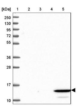 Western Blot: FAM36A Antibody [NBP1-91885] - Lane 1: Marker [kDa] 250, 130, 95, 72, 55, 36, 28, 17, 10<br/>Lane 2: Human cell line RT-4<br/>Lane 3: Human cell line U-251MG sp<br/>Lane 4: Human plasma (IgG/HSA depleted)<br/>Lane 5: Human liver tissue