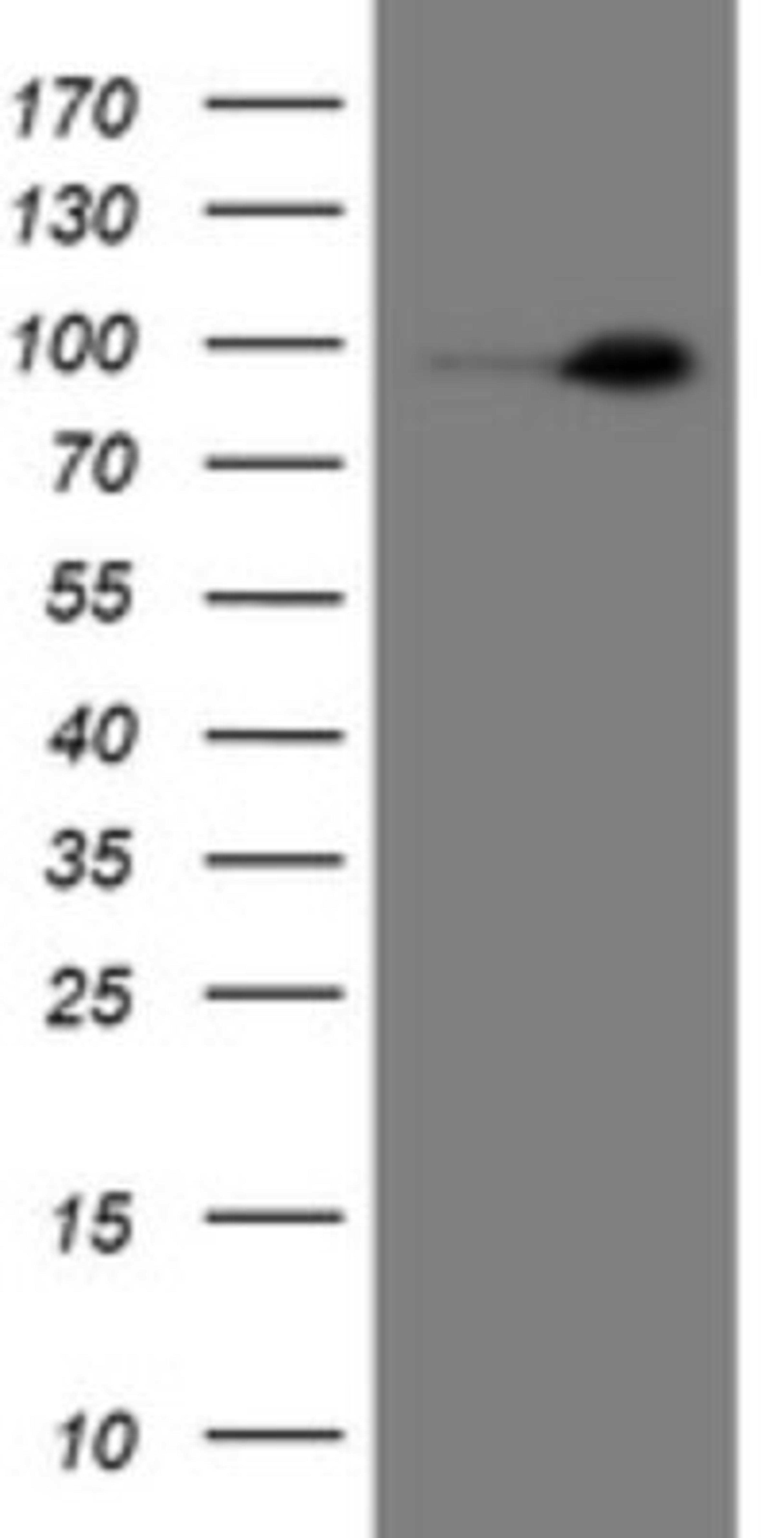 Western Blot: Neprilysin/CD10 Antibody (3D11) [NBP2-45817] - Analysis of HEK293T cells were transfected with the pCMV6-ENTRY control (Left lane) or pCMV6-ENTRY Neprilysin/CD10.