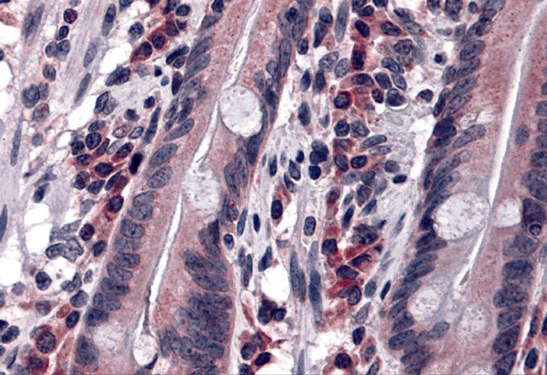 Immunohistochemistry of DISP2 in human small intestine tissue with DISP2 antibody at 5 μg/mL.