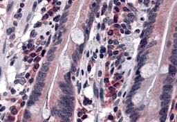 Immunohistochemistry of DISP2 in human small intestine tissue with DISP2 antibody at 5 μg/mL.