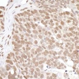 Detection of human PRMT1 by immunohistochemistry.