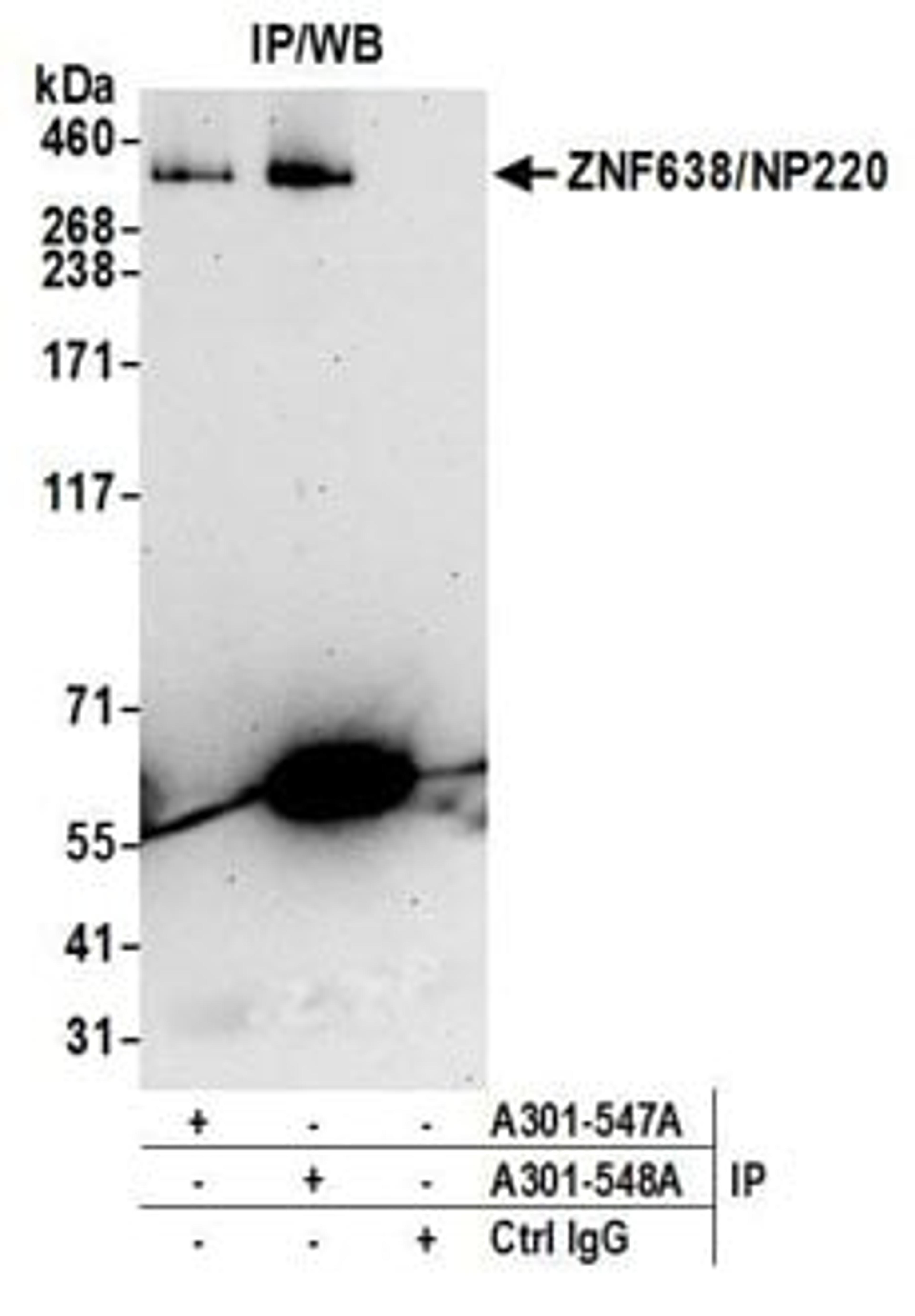 Detection of human ZNF638/NP220 by western blot of immunoprecipitates.