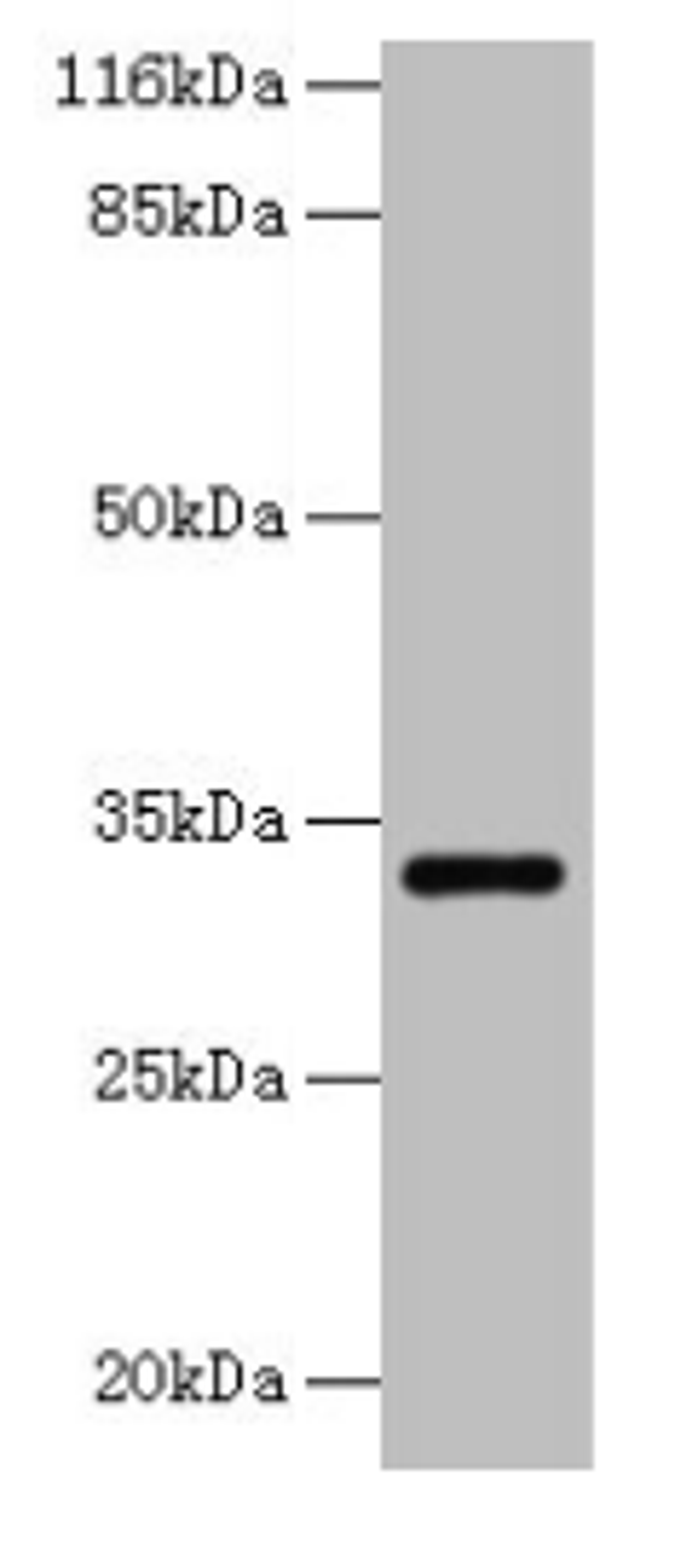 Western blot. All lanes: ERGIC1 antibody at 2µg/ml + HepG2 whole cell lysate. Secondary. Goat polyclonal to rabbit IgG at 1/10000 dilution. Predicted band size: 33, 23, 18 kDa. Observed band size: 33 kDa