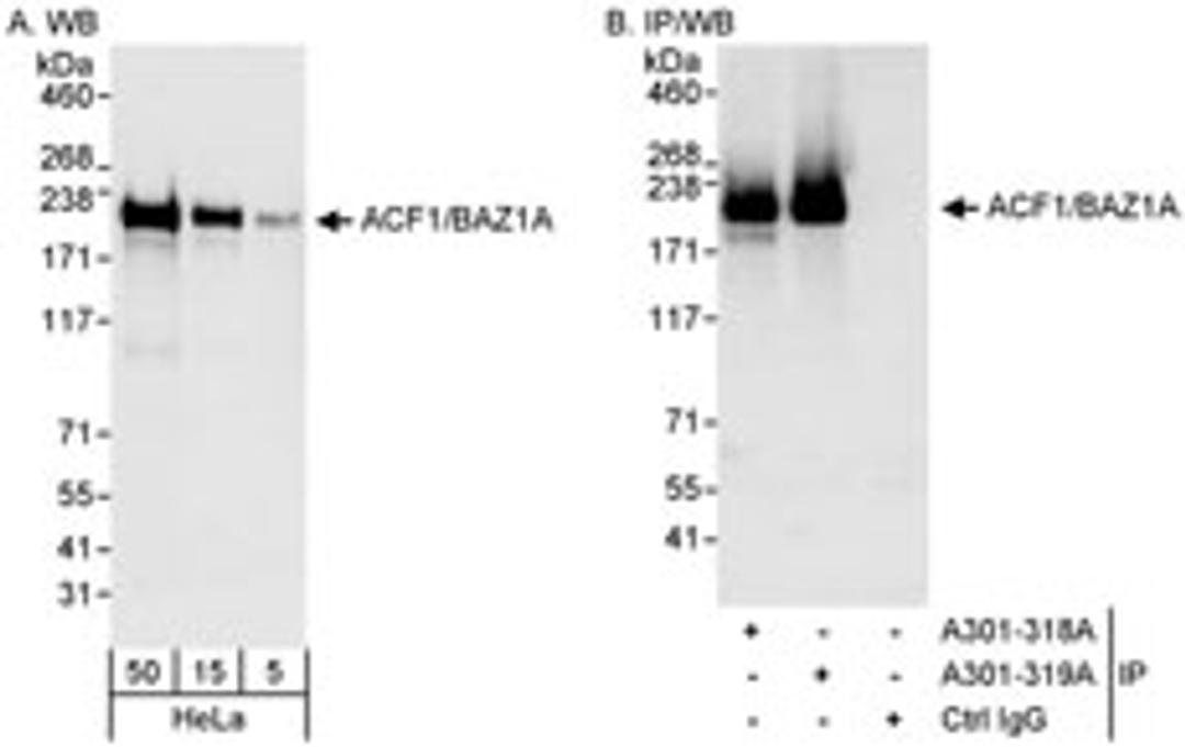 Detection of human ACF1/BAZ1A by western blot and immunoprecipitation.