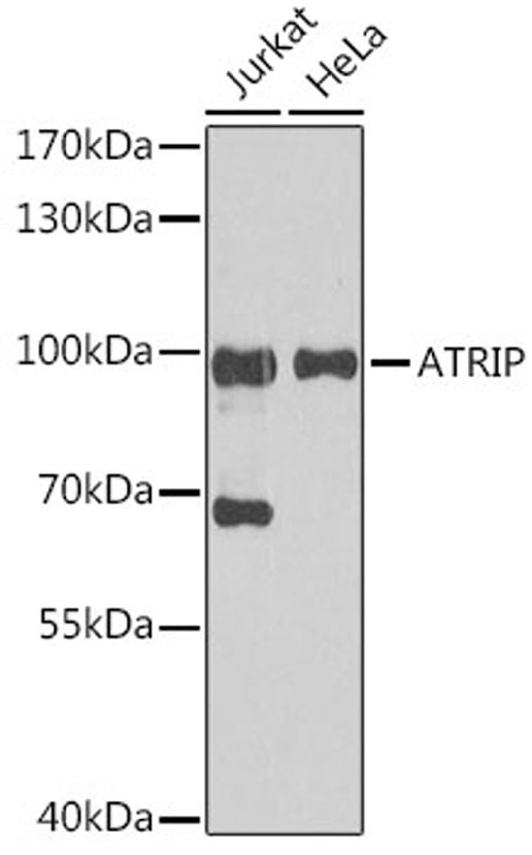 Western blot - ATRIP antibody (A5041)