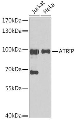 Western blot - ATRIP antibody (A5041)