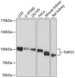 Western blot - TNPO1 antibody (A9435)