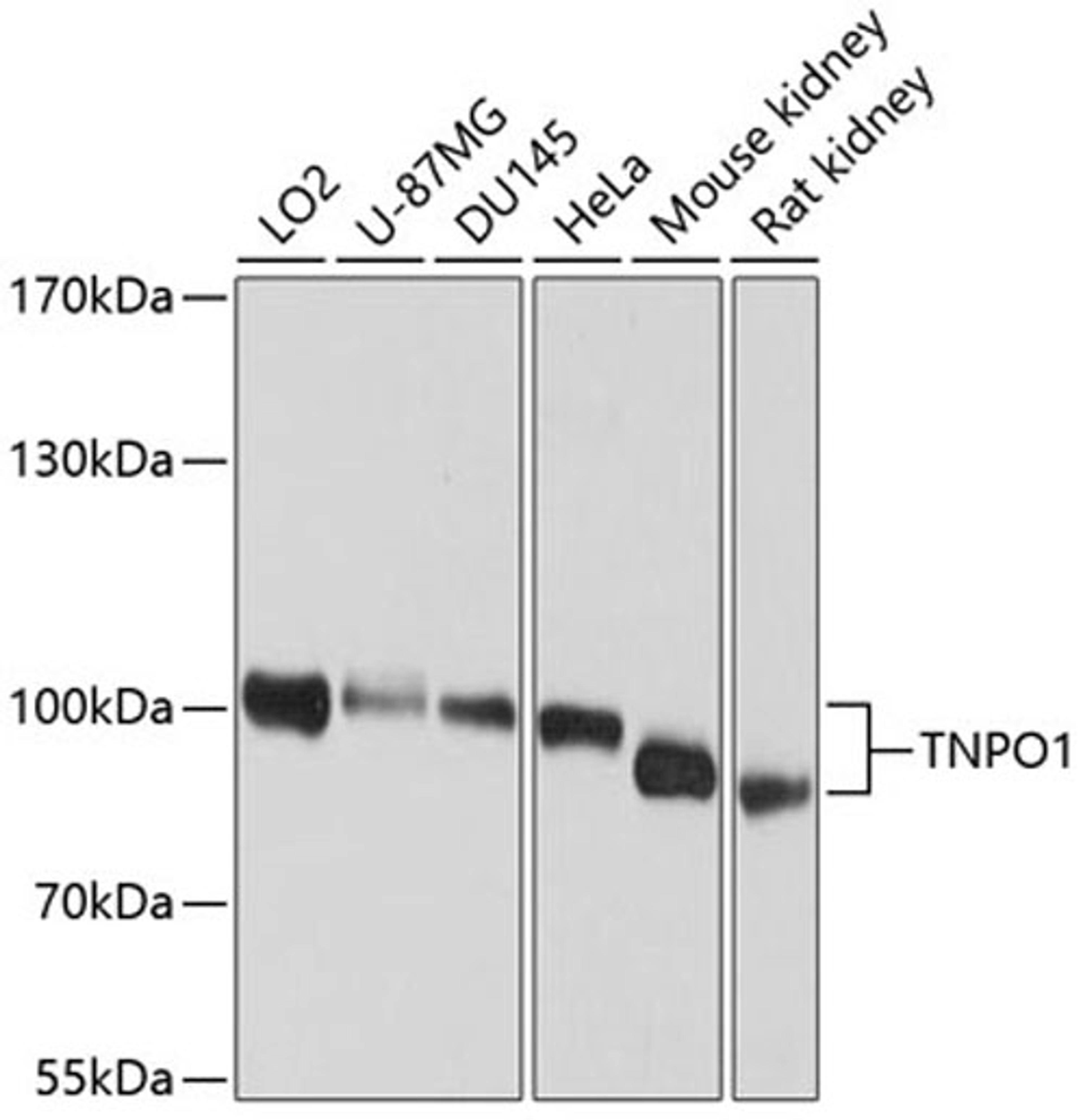 Western blot - TNPO1 antibody (A9435)