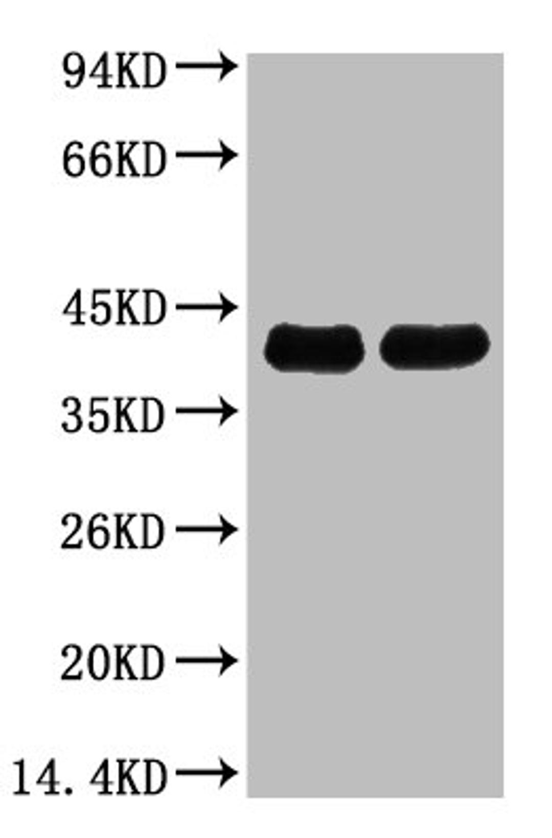 Western blot analysis of Arabidopsis, diluted at 1) 1:5000  2) 1:10000