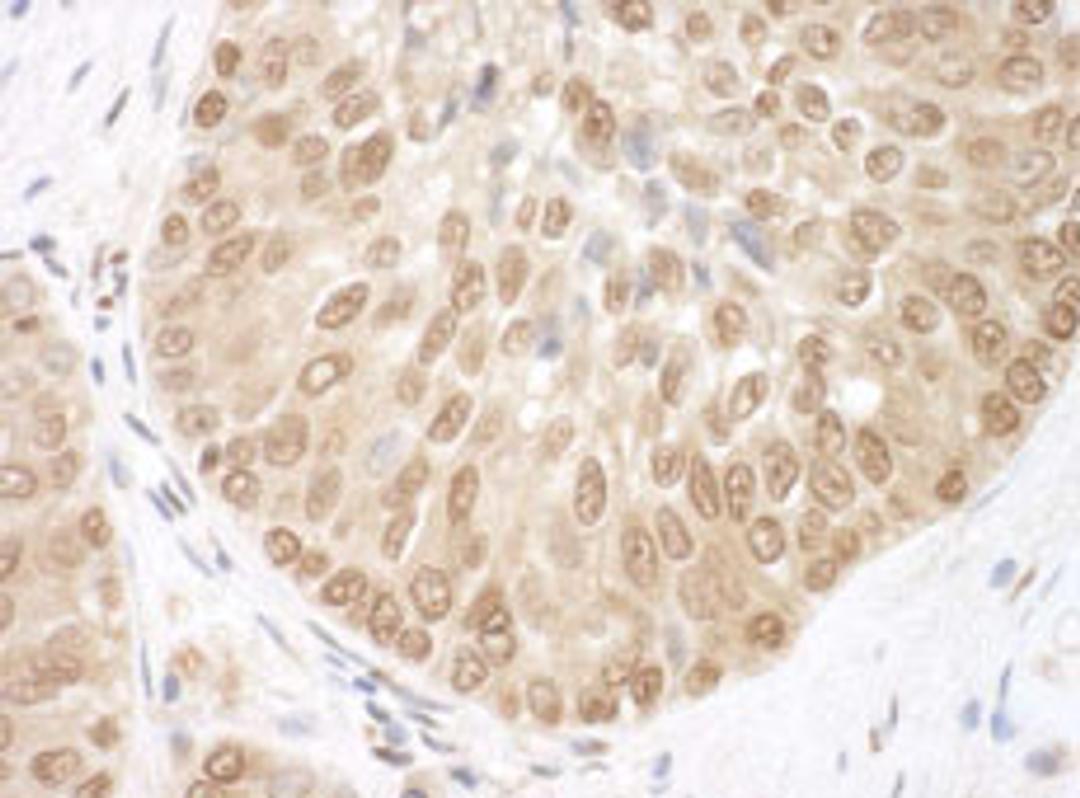 Detection of human BRCC36 by immunohistochemistry.