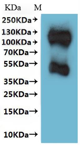 CSB-MP022726HU is detected by Mouse anti-6*His monoclonal antibody.