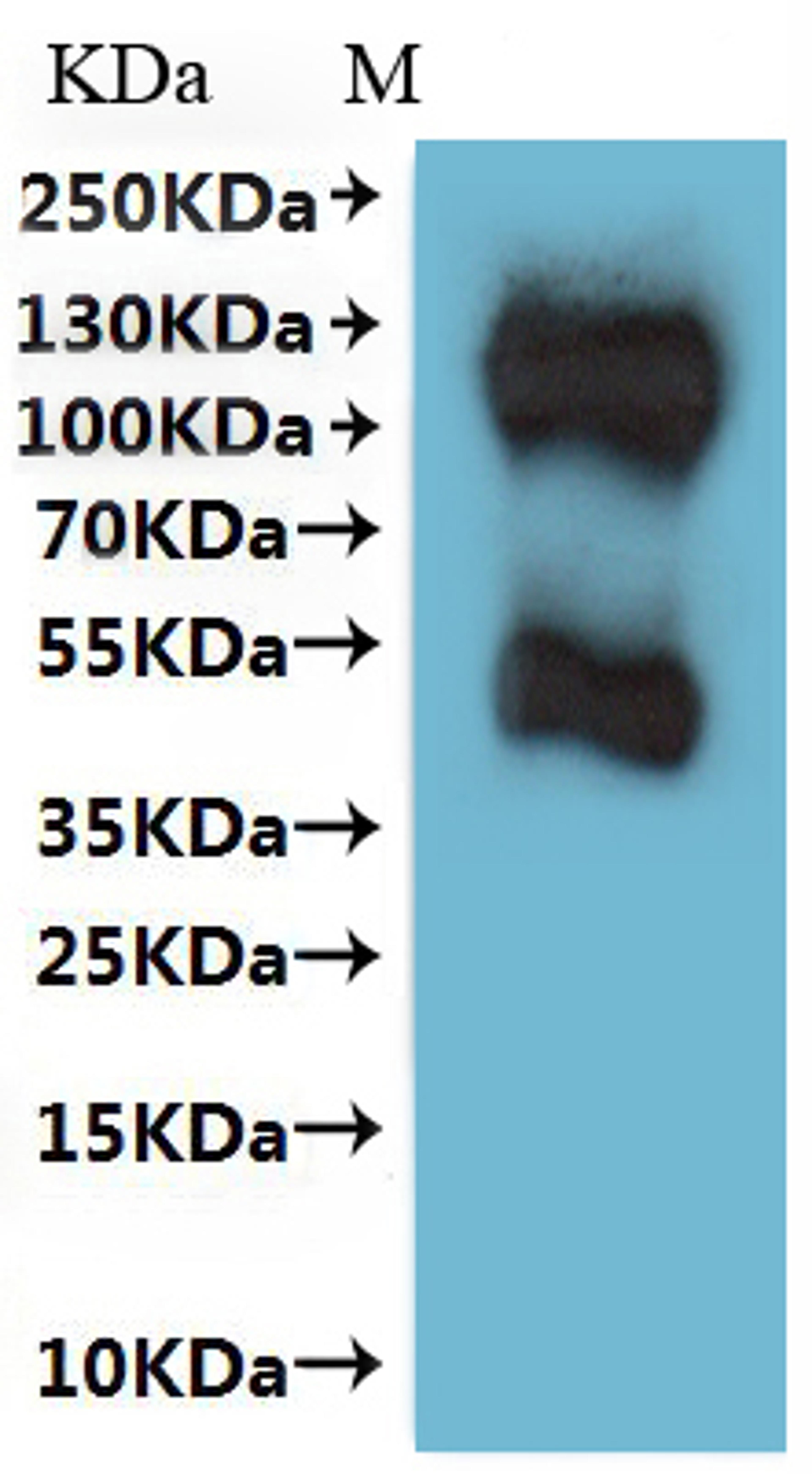 CSB-MP022726HU is detected by Mouse anti-6*His monoclonal antibody.