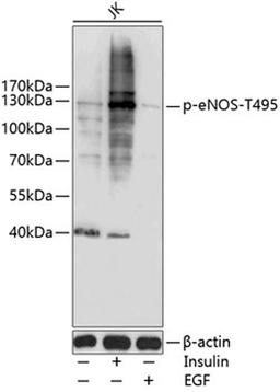 Western blot - Phospho-eNOS-T495 antibody (AP0516)