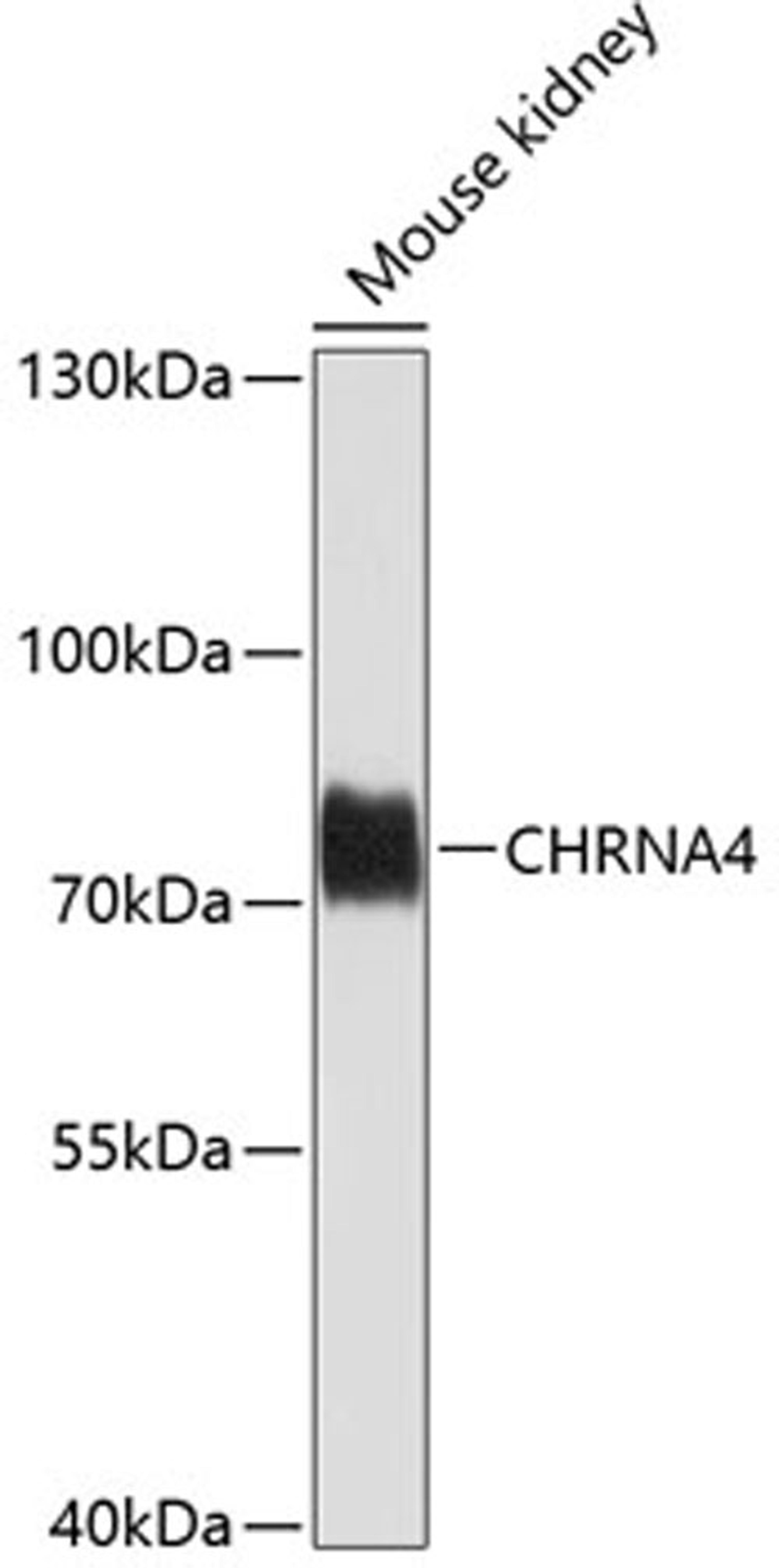 Western blot - CHRNA4 antibody (A1648)