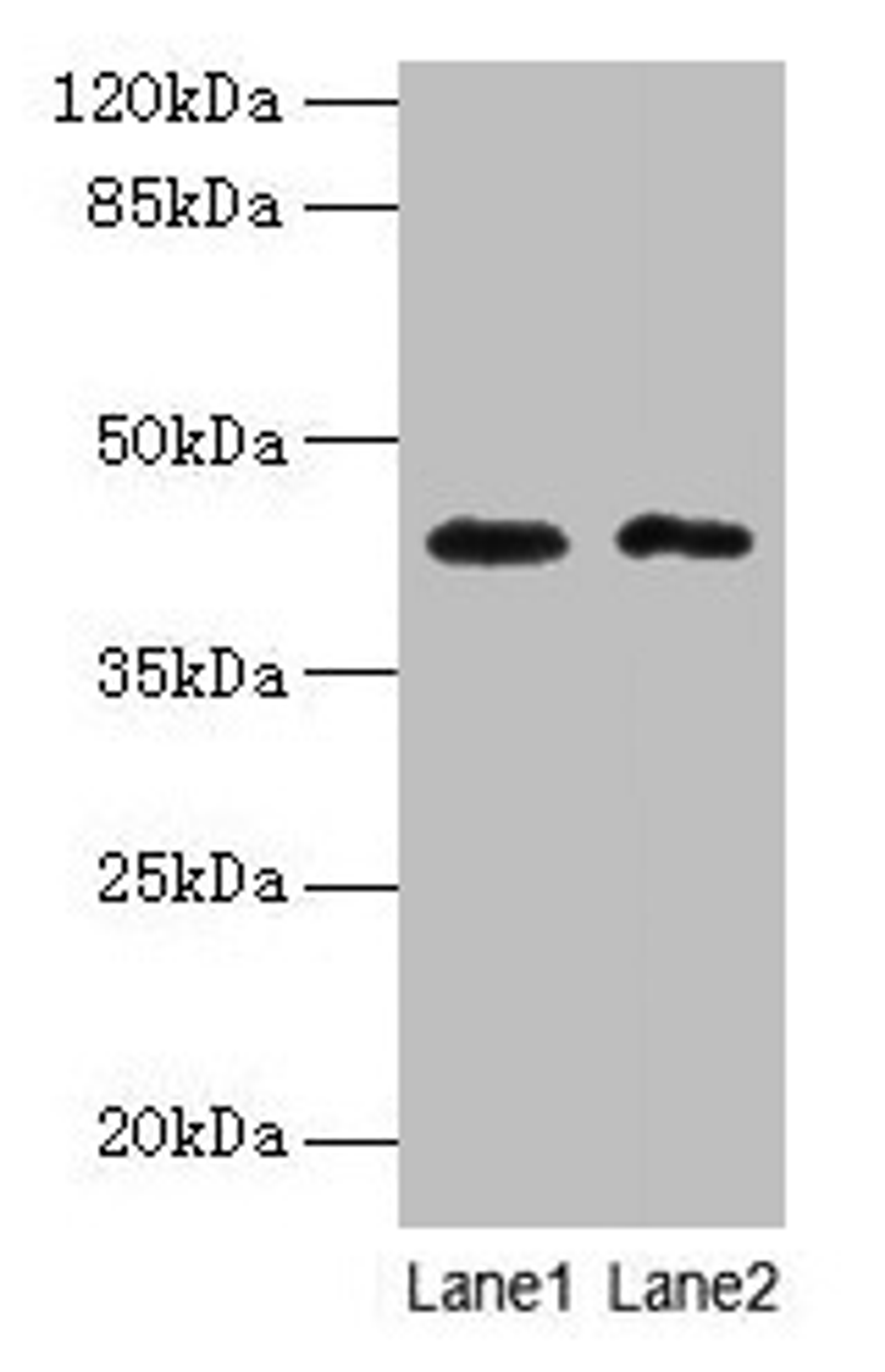 Western blot. All lanes: BTBD2 antibody at 6µg/ml. Lane 1: Hela whole cell lysate. Lane 2: MDA-MB-231 whole cell lysate. Secondary. Goat polyclonal to rabbit IgG at 1/10000 dilution. Predicted band size: 56, 23 kDa. Observed band size: 42 kDa