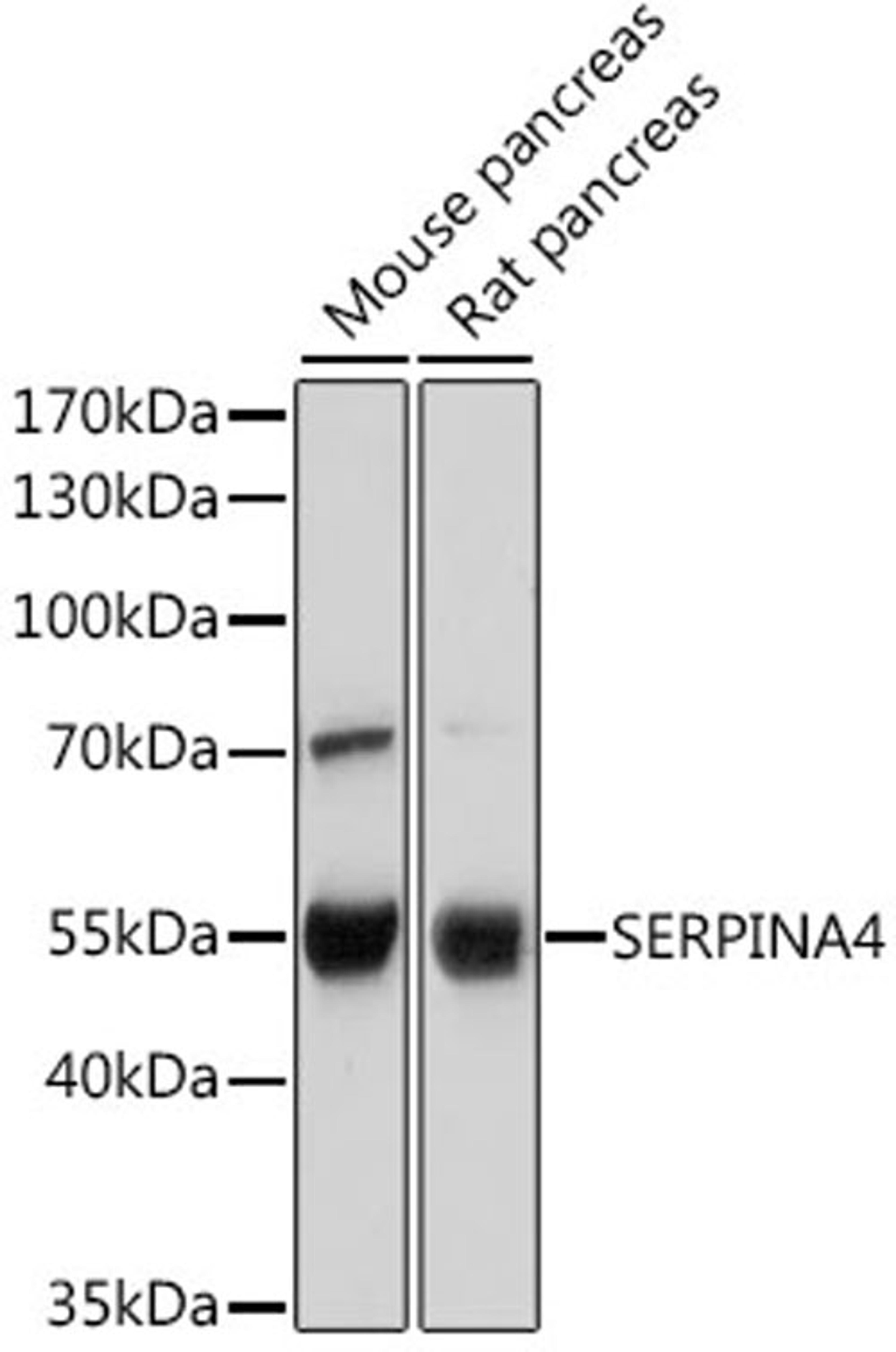 Western blot - SERPINA4 antibody (A7320)